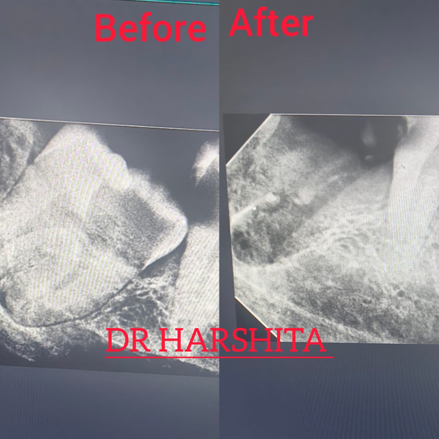 Before & After - Dental Treatment